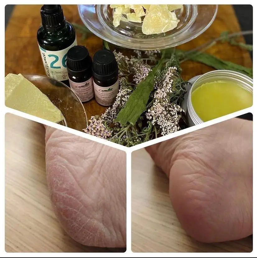 Heel & Feet Balm